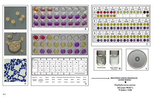 Key characteristics of Staphylococcus aureus