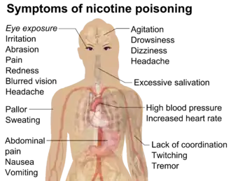 The most common adverse effects in e-cigarette calls to US poison control centers: Ingestion exposure resulted in vomiting, nausea, drowsy, tachycardia, or agitation. Inhalation/nasal exposure resulted in nausea, vomiting, dizziness, agitation, or headache. Ocular exposure resulted in eye irritation or pain, red eye or conjunctivitis, blurred vision, headache, or corneal abrasion. Multiple routes of exposure resulted in eye irritation or pain, vomiting, red eye or conjunctivitis, nausea, or cough. Dermal exposure resulted in nausea, dizziness, vomiting, headache, or tachycardia.