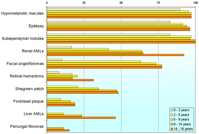 The frequency of signs in children, grouped by age[9]