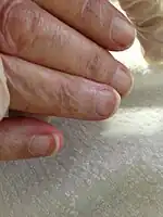 Terry's nails