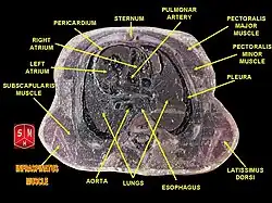 Imaged transverse section of the body through the thorax.
