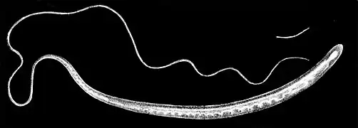 Female Trichuris trichiura