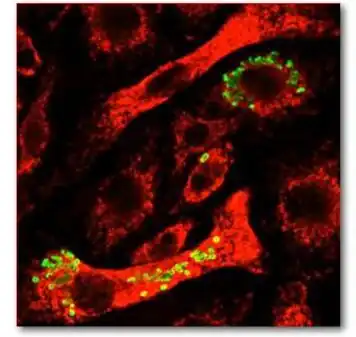 Virulent strain of green glowing, Francisella tularensis