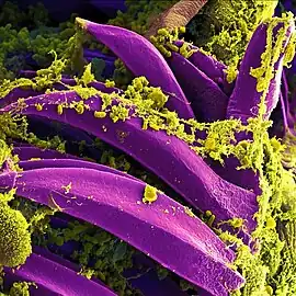 SEM of Yersinia pestis