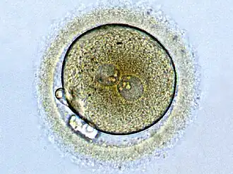 Zygote