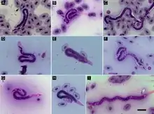 "Foleyella furcata" in the blood of lizards from Madagascar