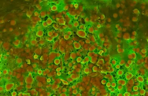 Density-Dependent Colour Scanning Electron Micrograph SEM (DDC-SEM) of cardiovascular calcification, showing in orange calcium phosphate spherical particles (denser material) and, in green, the extracellular matrix (less dense material)[71]