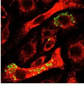 Image taken with a fluorescent microscope shows mouse macrophages 12 hours after infection with a virulent strain of Francisella tularensis (green)