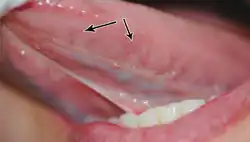 Caviar tongue grade 0