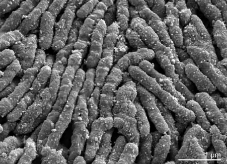 Scanning electron micrograph of S. moniliformis