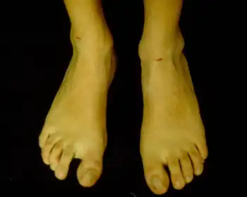 First toe is longer than the others and wide space between first and second toe.