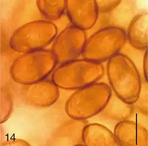 Metagonimus miyatai eggs