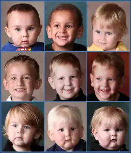 Broad forehead, round face, prominent ears