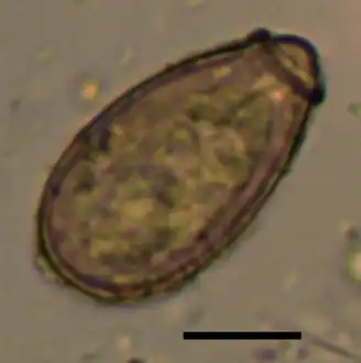 Egg found in the persons stool by a sedimentation method