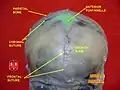 Anterior fontanelle