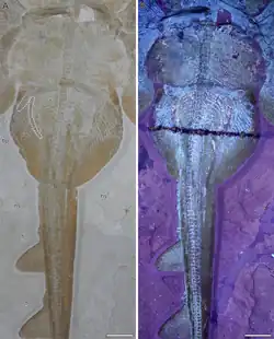 Pelvic region