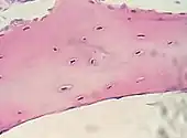 Bone, cell nuclei (blue-purple), bone matrix (pink)