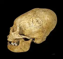 Proto Nazca elongated skull, c. 200–100&nbsp;BCE