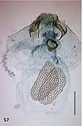 Female genitalia