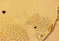 Cnidocysts