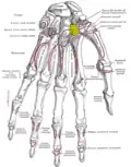 Trapezoid shown in yellow. Left hand. Palmar surface.