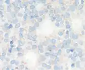 1+