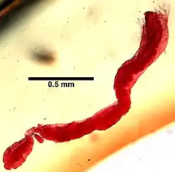 Limnodriloides medioporus