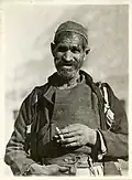 Macedonian man, National Museum of Health and Medicine