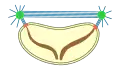closed , extranuclear , pleuromitosis