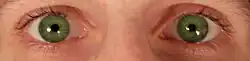 Eyes open, pupils smaller than expected and equal