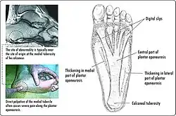 anatomical diagram