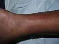 Feet and ankle view