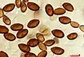 Spores magnified