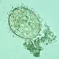 Schistosoma mekongi