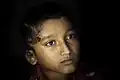 Ten-year-old Idris lost part of his ear due to a bullet and survived. He was still unable to stand on his own several months after the incident.